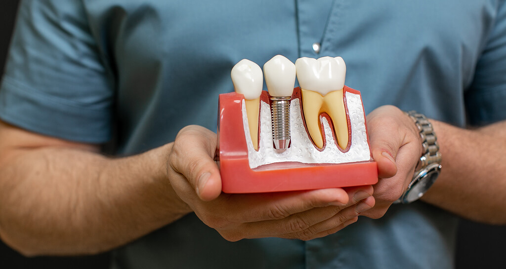 How Long Should I Wait For A Dental Implant After Extraction​?