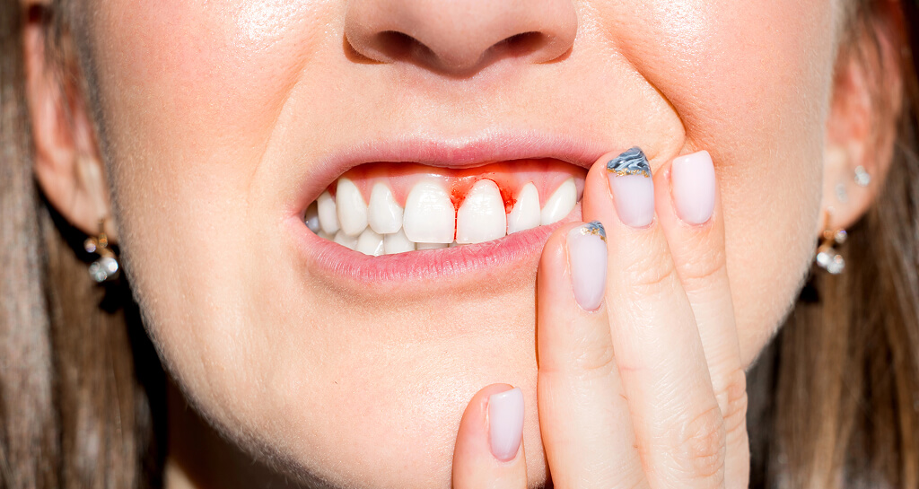 How Long Can You Keep Your Teeth with Periodontal Disease?