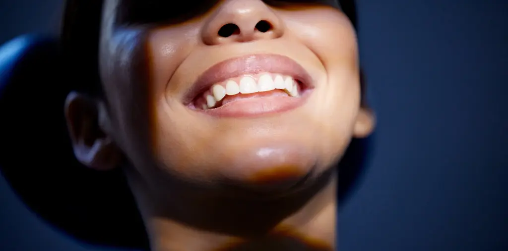 Does Teeth Whitening Hurt? What to Expect Before, During, and After Treatment